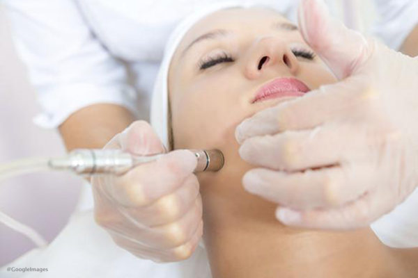 Diamond Microdermabrasion